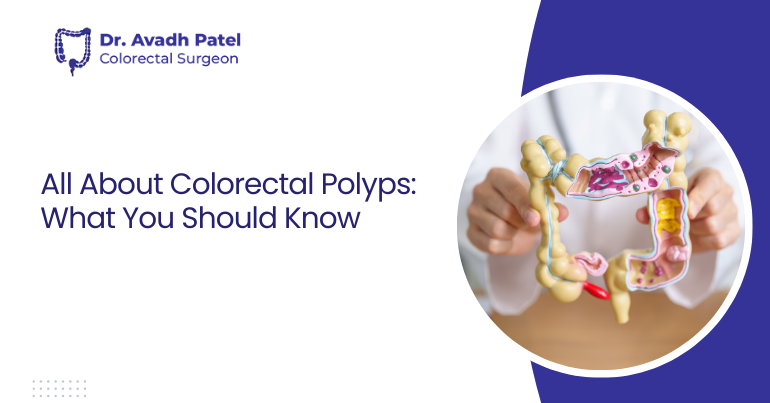 All About Colorectal Polyps: What You Should Know
