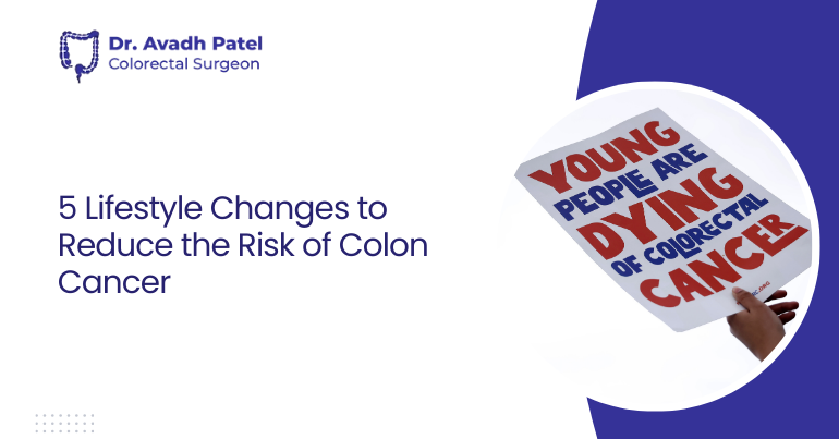 5 Lifestyle Changes to Reduce the Risk of Colon Cancer