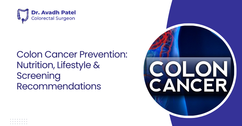 Colon Cancer Prevention: Nutrition, Lifestyle & Screening Recommendations